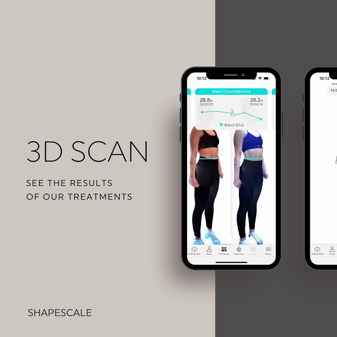 Shapescale 3D Scan