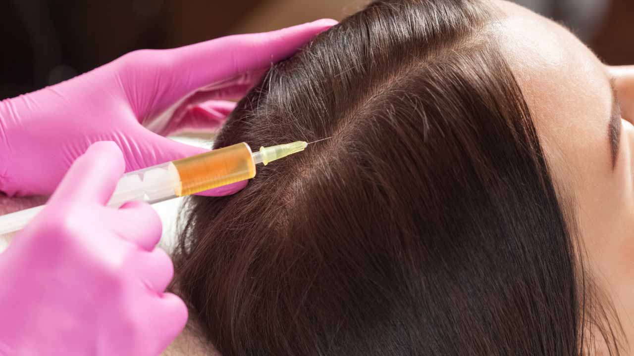 Why Choose PRP Hair Restoration